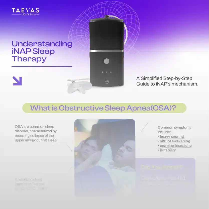 Understanding iNAP sleep therapy - A Simplified Step-by-Step Guide to iNAP’s mechanism