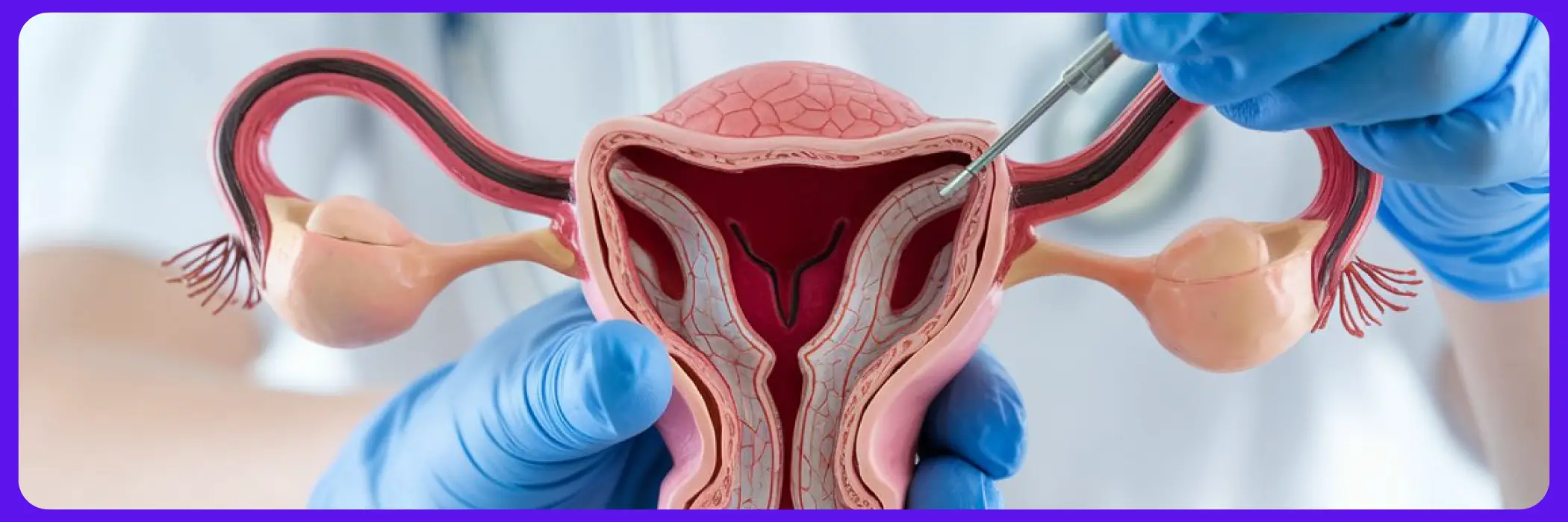 Cervical Cancer in India How HPV Testing Can Save Lives